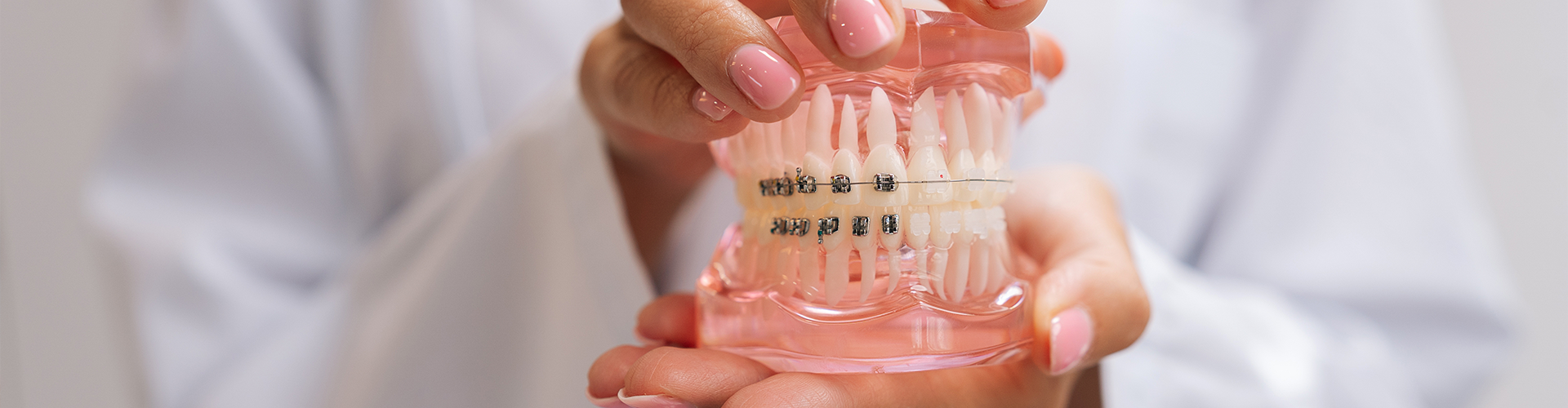 Hands holding mouth model with metal and clear braces.